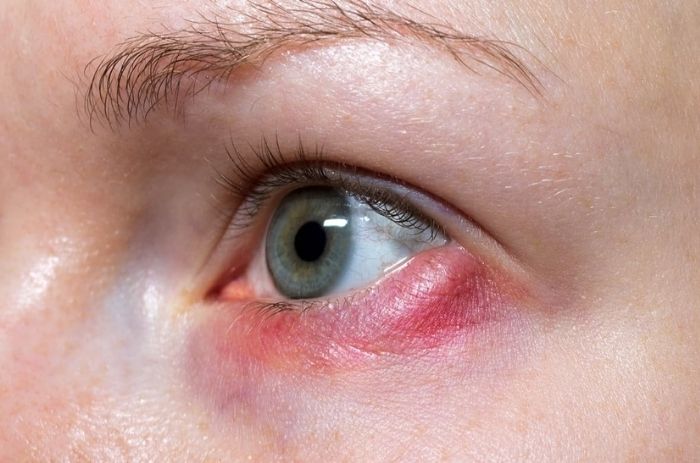 Arpacık Evde Tedavi 